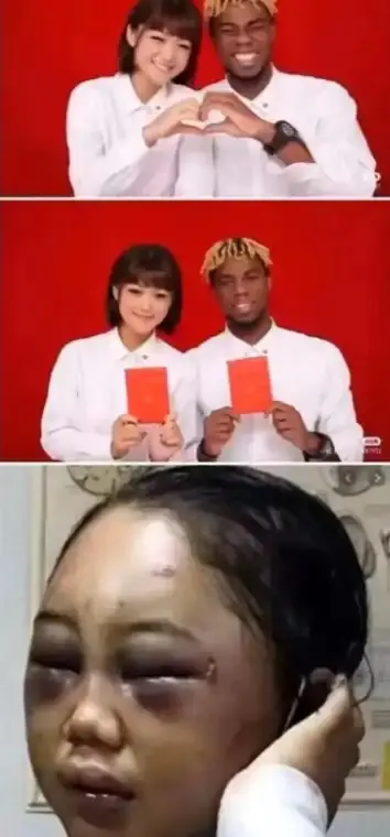 非洲的蚊子太厉害了