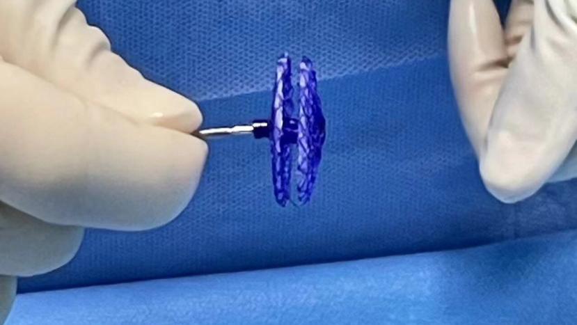 以为的“颈椎病”竟是“小心眼”在作怪，医生“无痕”补心根治顽疾