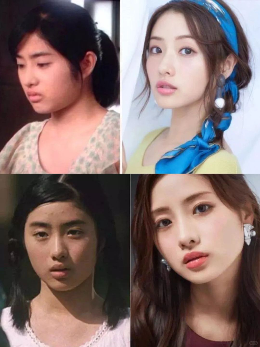 怎么没人说石原里美的整商
1⃣️皮肤变白
2⃣️眼睛有神
3⃣️面部轮廓清晰
4