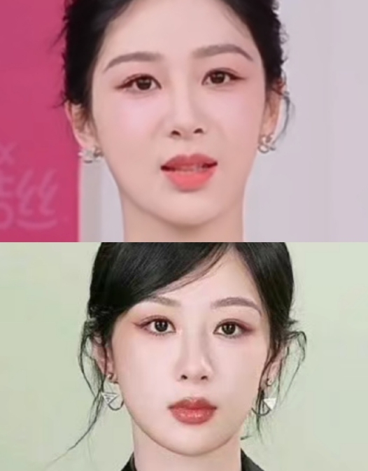 紫妹又改脸了，我怀疑她做额头提升或者颞部提升了。
眉眼间距拉开了，眼尾上扬了，主