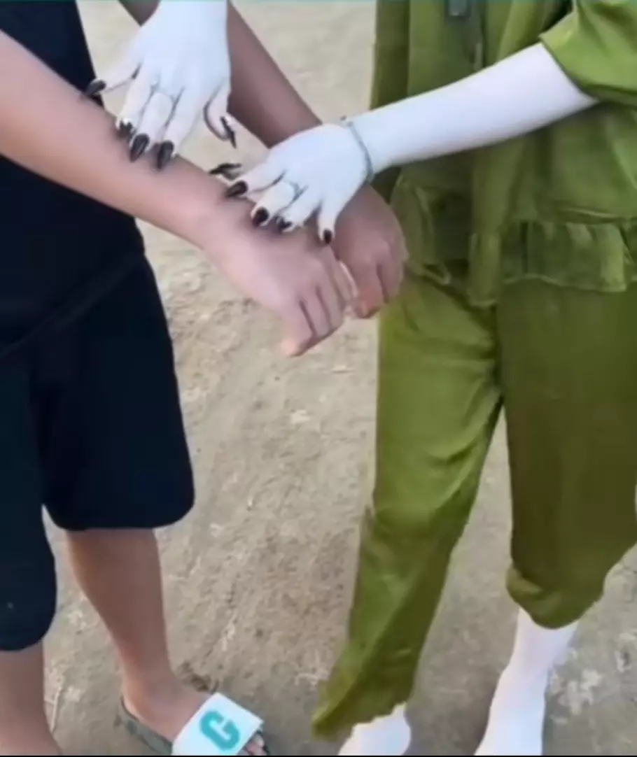 女朋友皮肤很白。她说天生的，我总觉得不对劲。