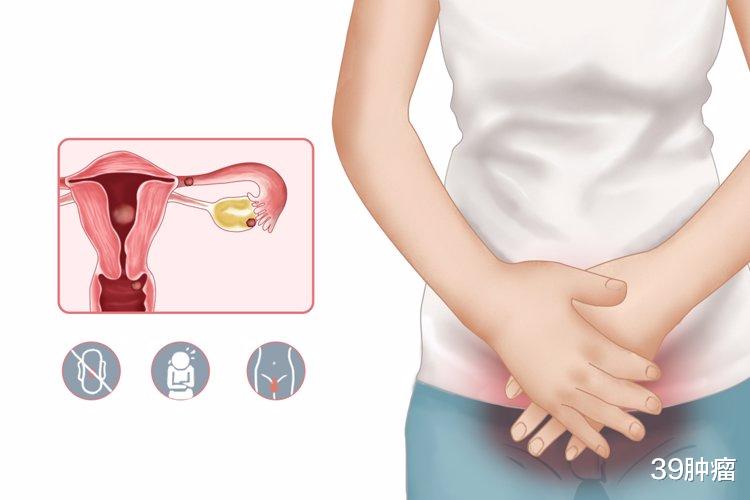 如果出现突然腹痛、阴道异常出血、阴道异常流液、外阴红肿疼痛、摸到肿块等情况，应随时到医院就诊。