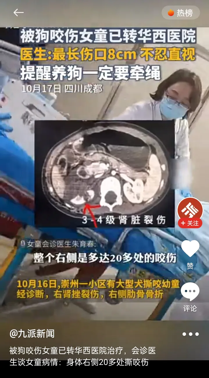 郑州城管巡查未拴绳养狗行为#被咬的女童能不能唤醒你那点残存的人性？