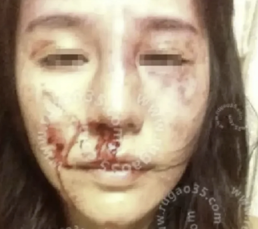 “山东德州，妻子胆大包天，丈夫在二楼睡觉，她在一楼与情人私会，遭到丈夫发现随手抄