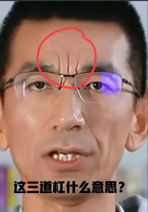 最近大家都在讨论孙东旭脑门上的川字纹

有人说是北京人，满族，通天纹，天选之子
