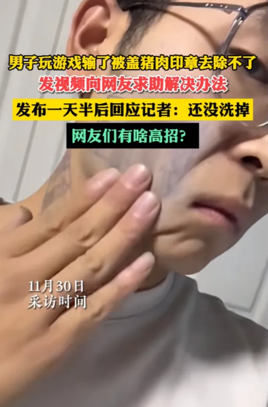 男子玩游戏被盖猪肉印章去除不了
一男子玩游戏被盖猪肉印章，印章根本去除不了！
 