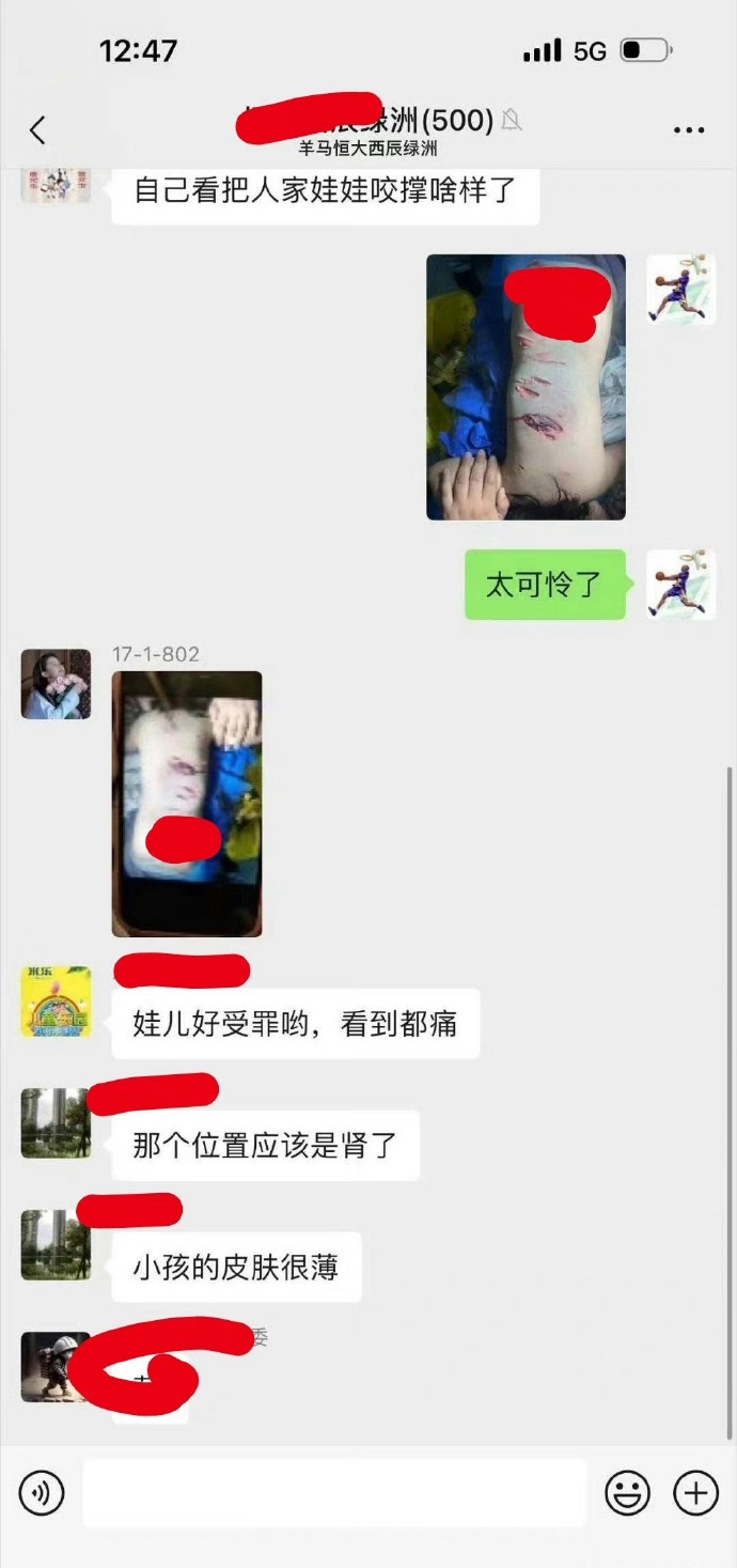 养大型禁养猎犬，不牵绳散养，导致女童受伤严重，此狗主人已被刑事拘留，应该按危害公
