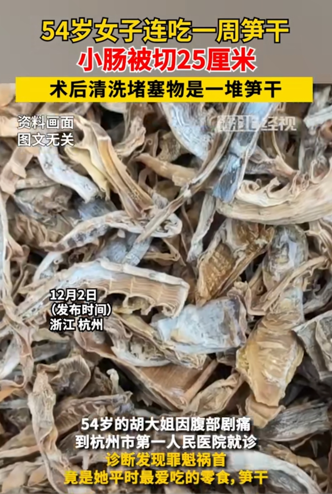 近日，浙江杭州的一位中年妇女因连续食用笋干长达一个星期，结果不幸患上了肠梗阻，最