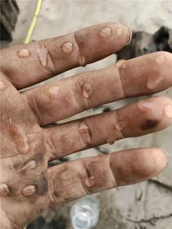 来报应了？核污水有反响了。。。
现在第二轮的核污水排放已经3000多吨了，再加上