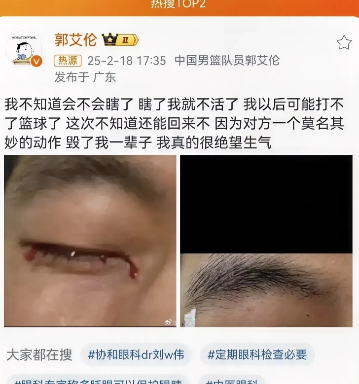 郭艾伦自己发文，我以后可能打不了篮球了，
隔着屏幕看他发的照片，都会觉得眼睛痛，