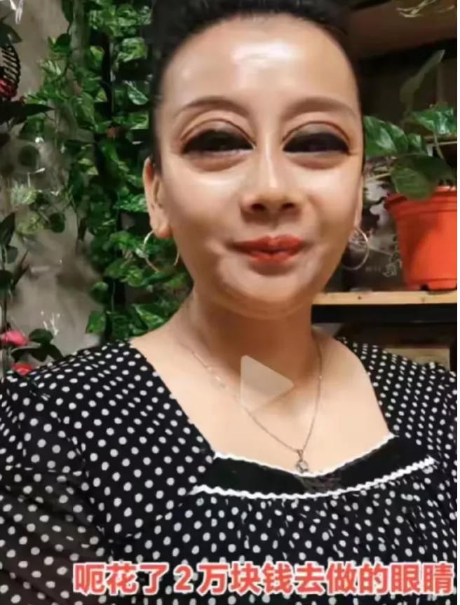 不可思议！有一名女子为了爱美，花20000块钱到医院做割眼皮跟开眼角，从医院回来