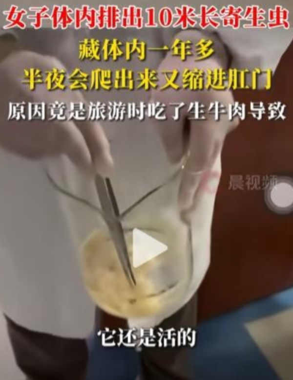 2024年上海，一女子洗澡时突然想上厕所，拿纸一擦却发现了2厘米长的白色东西，仔