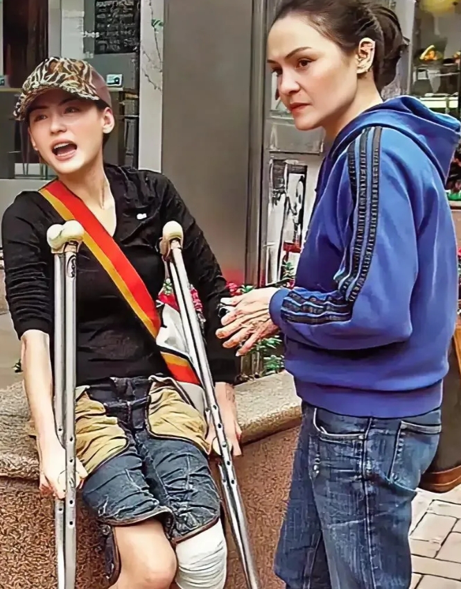 一次，张柏芝摔伤了腿，妈妈一边责骂她不小心，一边心疼她带她去换药！
张柏芝的妈妈