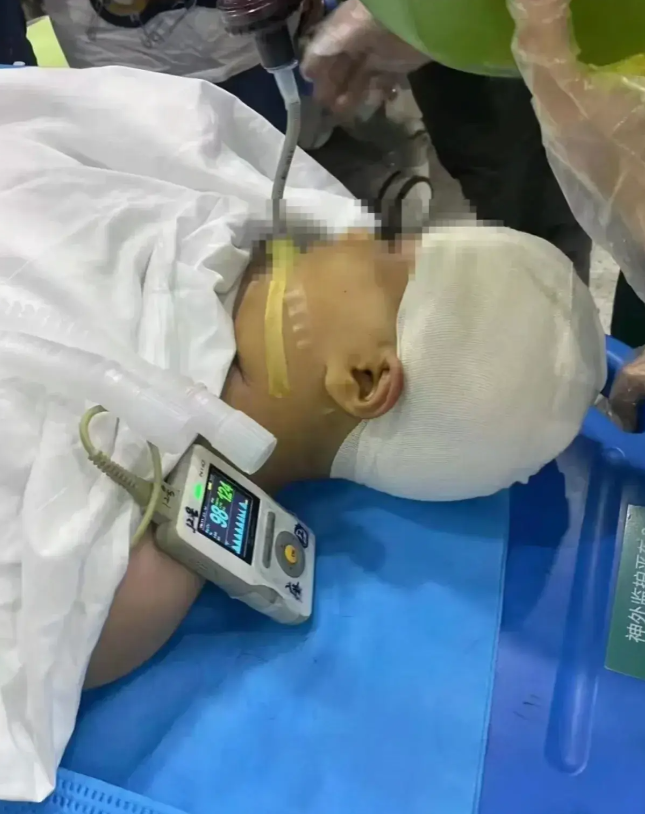 枉为人师！长沙9岁女生被老师用三角尺砸伤，导致其颅骨破裂，构成重伤二级，家长找到