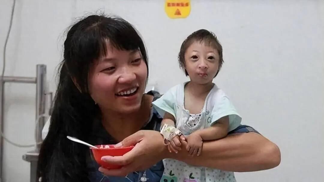15年前湖南夫妇生了个“小猴子”，马戏团想5万买下，现在怎样了