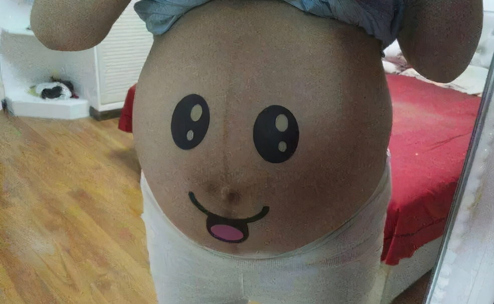 孕妈肚脐周围变黑是怎么回事儿呢？