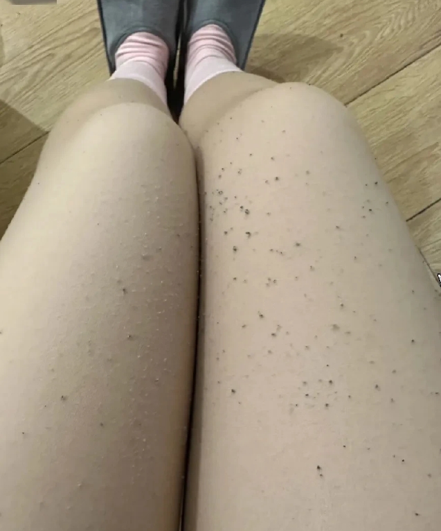 家人们，我真的要崩溃了！花大价钱买的觅橘光腿神器，本想着能美美过冬，结果刚穿第二