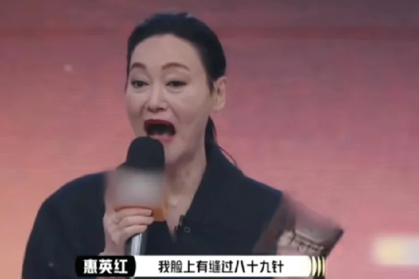 熊乃瑾:我没整容
《演员请就位3》导师说整过容的请站起来，只有刘梓晨站起来，导师