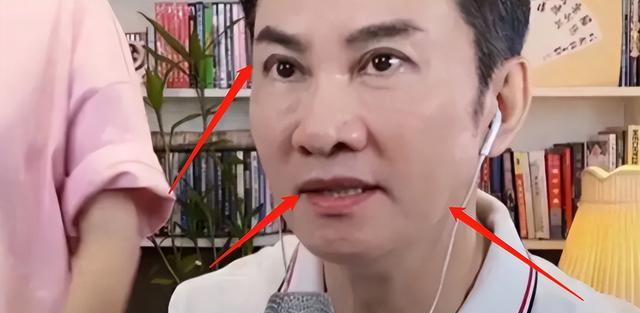 宁愿丑成“怪物”也要永葆青春，这7位明星早已整的“惨不忍睹”（十大明星整容失败）-第14张图片-九妖电影