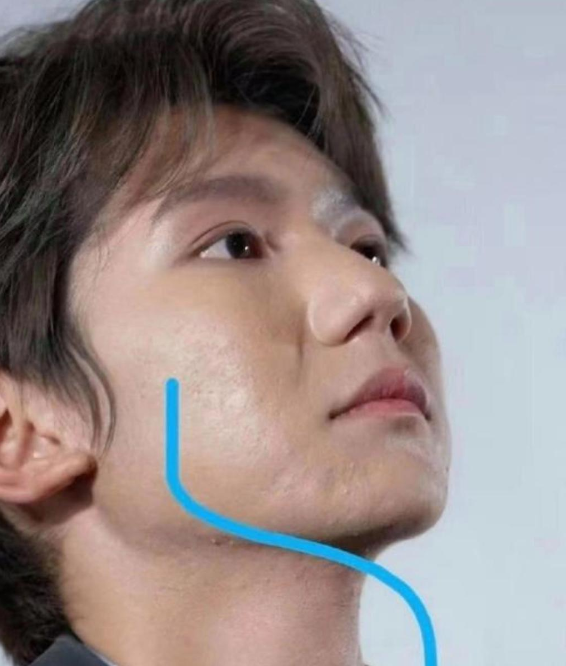 王源自己也应该很难过吧？真实的皮肤状态看起来像是30多岁。

王源的真实皮肤状态