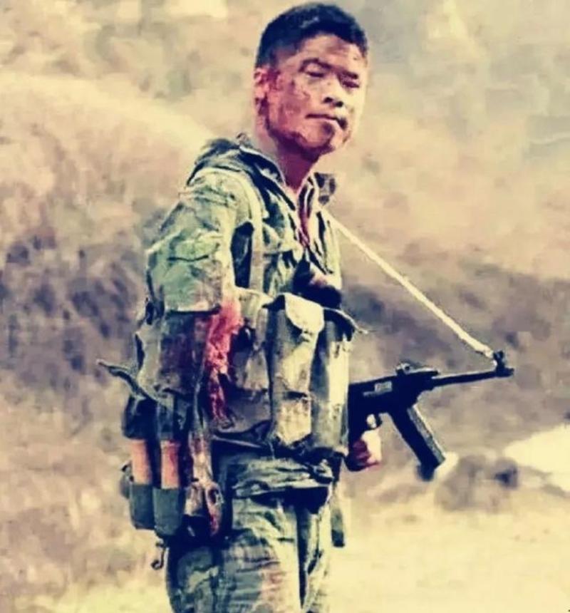 这是一张对越自卫反击战中的真实照片，照片中的士兵割下自己的右臂，以便能够继续战斗