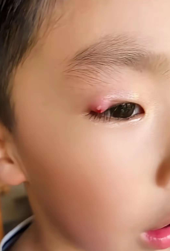 你们看一下我弟弟这眼睛怎么了？？？？有懂的吗……
