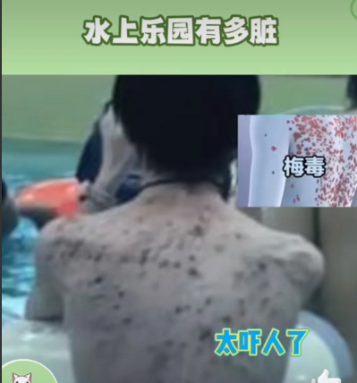 水上乐园，竟然成了毒源！！！
我曾经听到一个水上乐园的员工爆料。说水上的水，基本