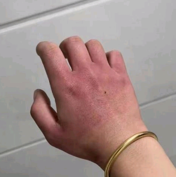 嫂子去出差了，在家无聊就拿着她的手镯戴了起来，结果今天怎么取都取不出来了，她马上