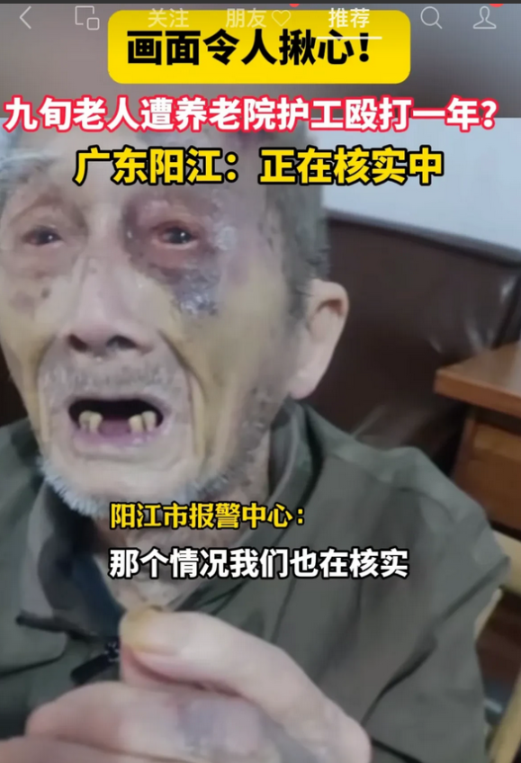 90多岁的老人在养老院遭护工殴打一年有余？看老人被打的面目全非，满脸青紫，眼睛周