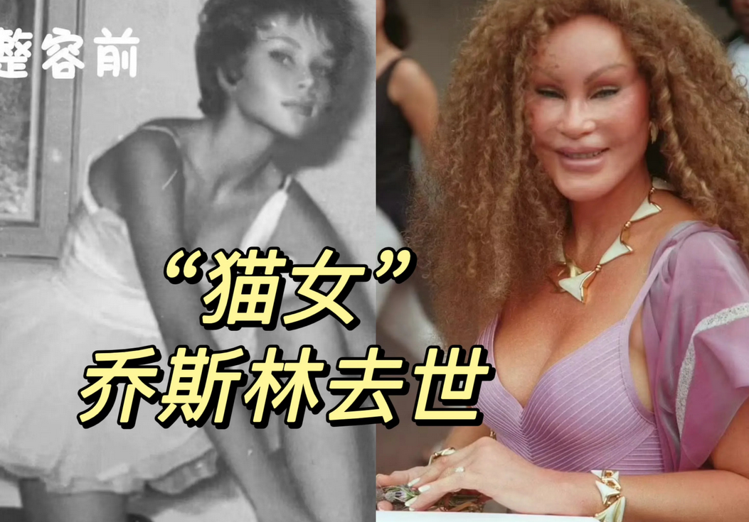 84岁“猫女”去世，传奇落幕！
第一代网红“猫女”去世，享年84岁！
乔斯林男友