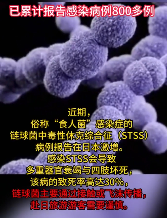  旅游又不是什么生活必需品，不怕一万就怕万一，世界这么大非得去日本吗？

又是核