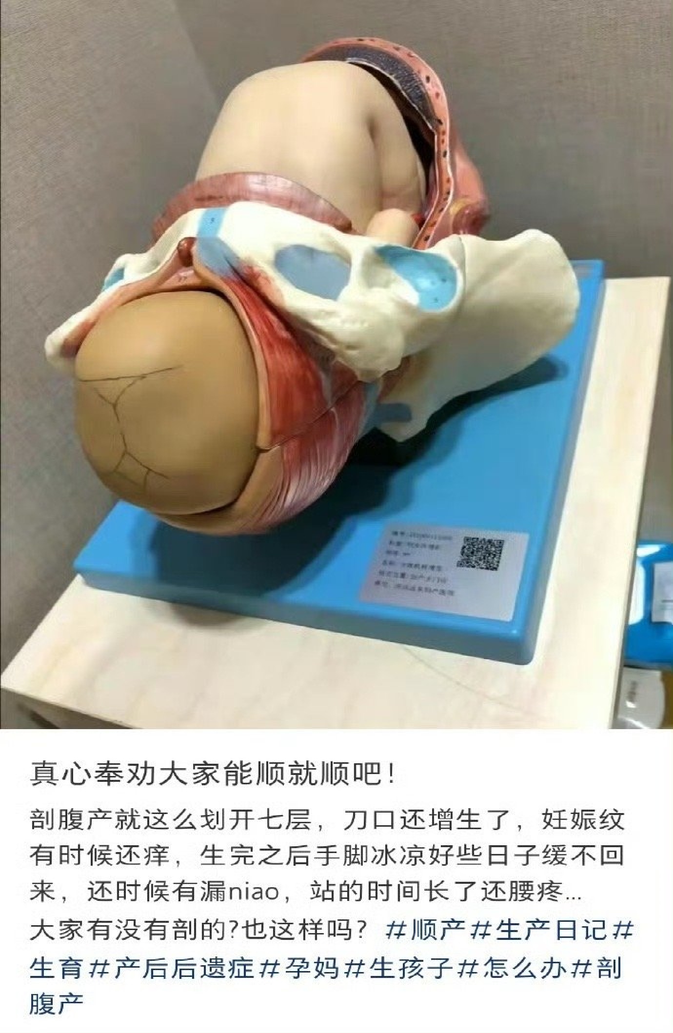 顺产的含金量还在上升... ​​​