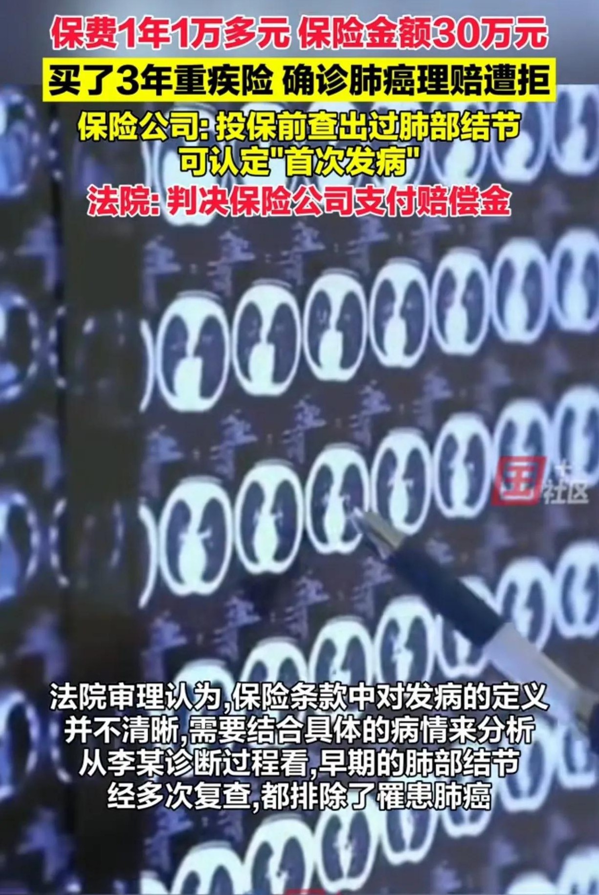 江苏一名男子在体检中发现肺部有结节，为了防止病情恶化，他选择购买了一份保险。然而