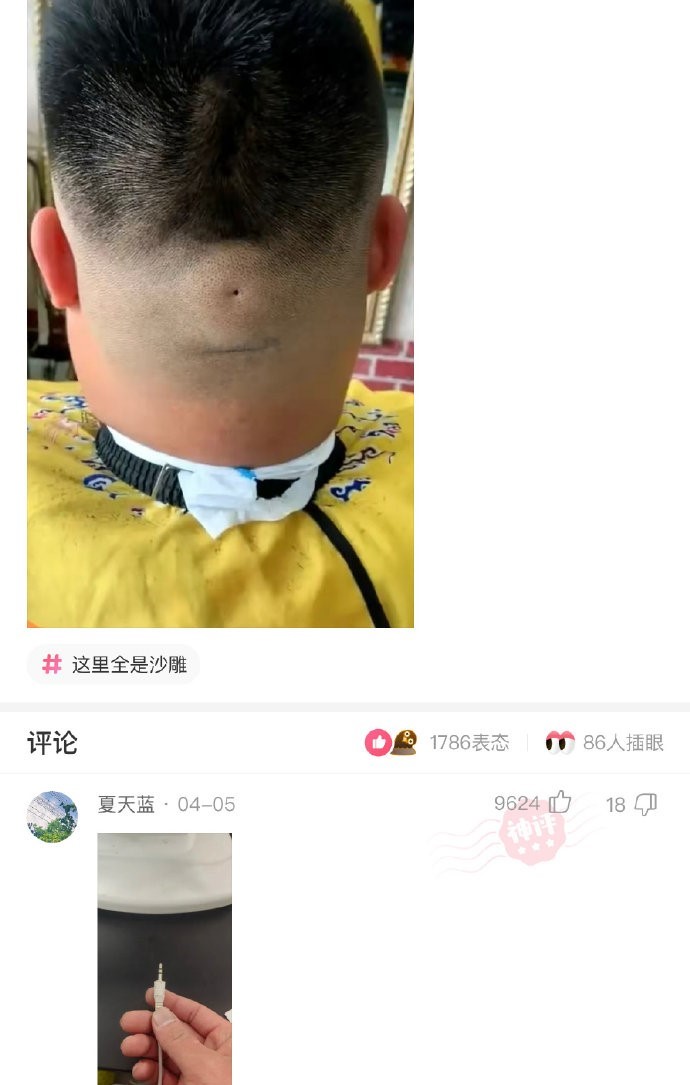 后脑勺有个洞是咋回事？