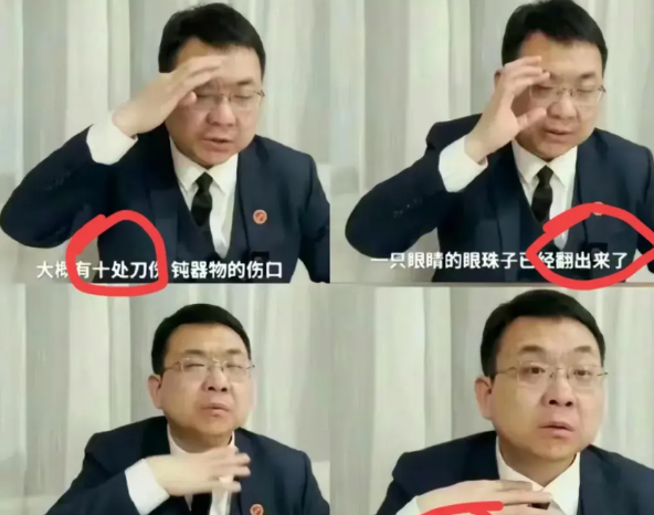 看着就让人冲动！

大家看过王子耀事件代理律师讲述尸检情况吗？

臧梵清作为一个