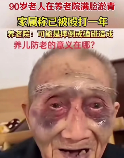 这就是住养老院的下场
       这位老人90岁，发视频者是他的孙子，称他的爷