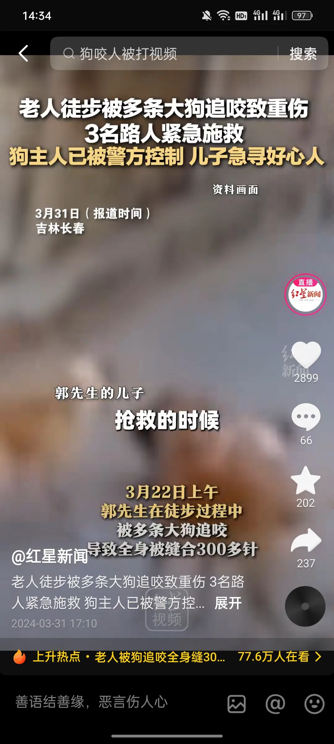 城市应该禁止养大型犬！

