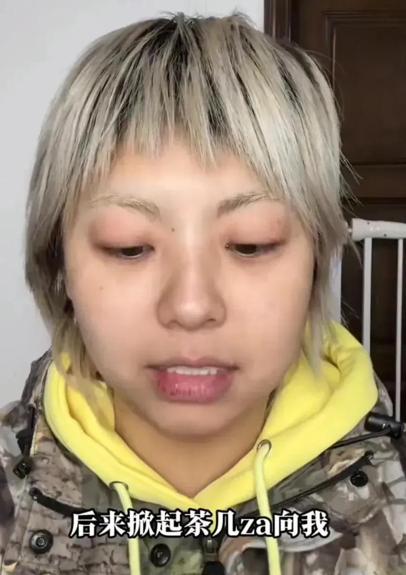 原来，张大大手段很辣，酒店虐待女员工的背后，保护伞竟然是他！
女网友“黄毛毛”爆