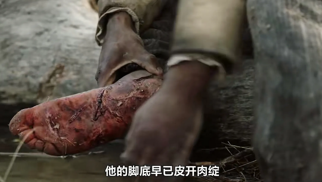 人类在没有发明鞋子之前，怎么到处奔跑的？很容易被刺的血肉模糊，而且也会迅速磨损。
