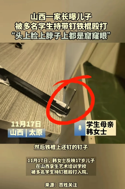 校园霸凌何时休？家长爆料儿子在学校被多名同学用带铁钉的铁棍殴打得身上都是窟窿眼！