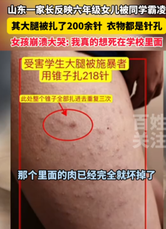 “这还是教书育人的学校吗？”山东济南，一家长发现自己女儿的校服上面全是针孔，掀开