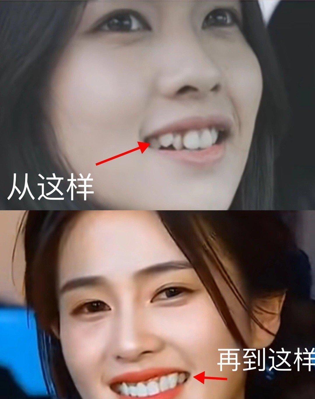 白鹿的牙齿前后差别不大，整体看起来差不多