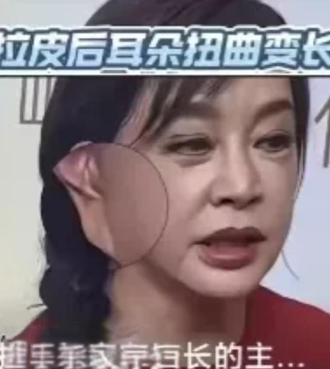 刘晓庆拉没拉皮一看便知。
年轻时候皮肤紧致不假。
可上了岁数还能保持紧致。
从图