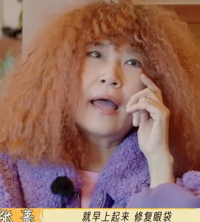 难怪张蔷老喜欢戴着墨镜，原来是把眼袋做坏了