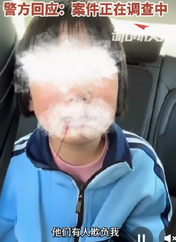 山西晋中，女孩被学校霸凌，打得满嘴都是血，父亲看了监控说，不追责，网友愤怒了，这