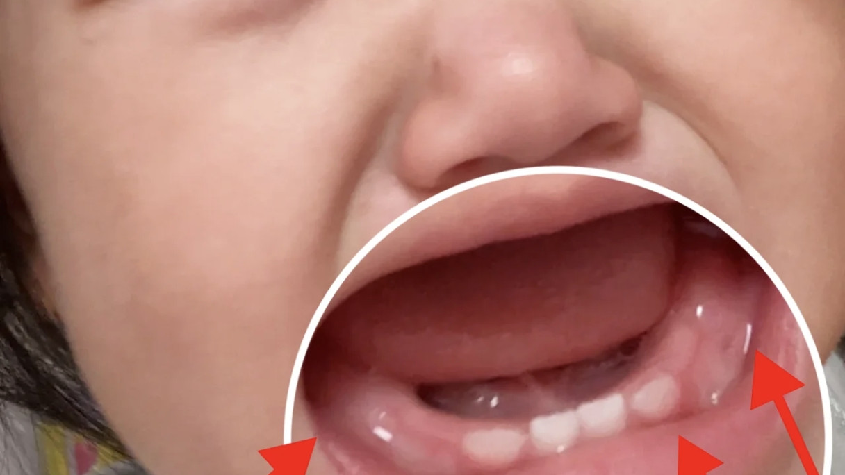 婴幼儿口腔什么时候需要开始护理刷牙呢?