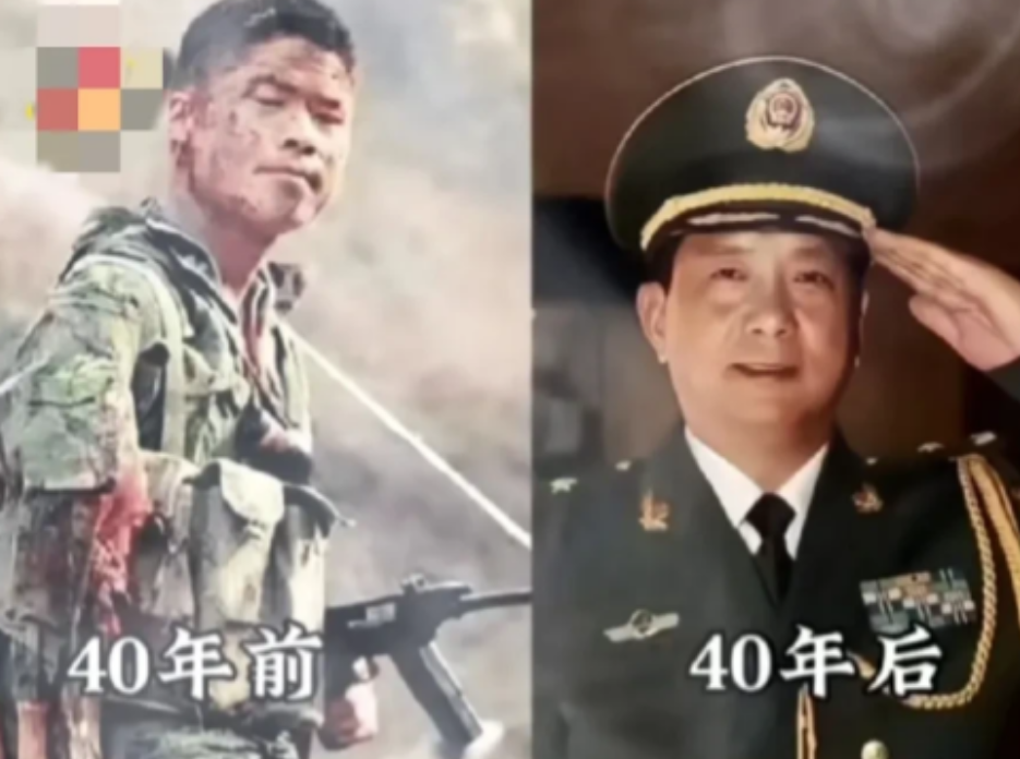 1984年老山战役中，手臂被炸伤他用匕首切断连着骨头的肉，把断臂別在腰上，扛着俘