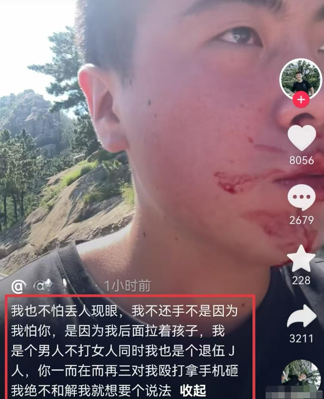 青岛那被打的哥们后来说了9句心里话：
1. 第一句，我没还手，因为我当过兵，知道