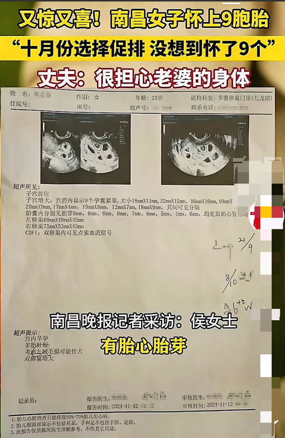 天呀！南昌一女子促排，怀9胞胎！
这下好了，8个瑞士卷不够分了！
不敢想象如果9