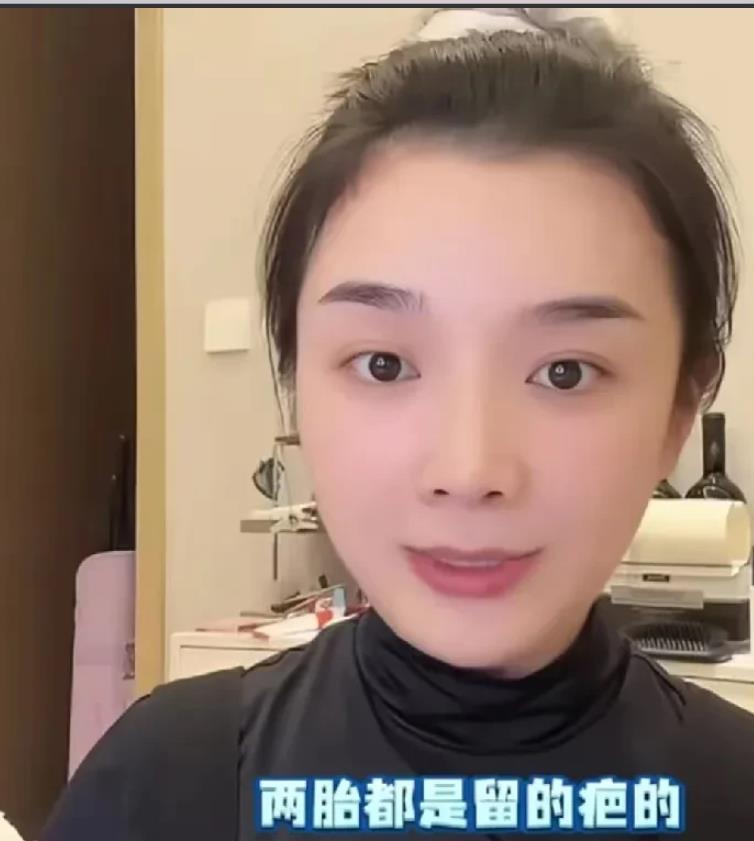 王栎鑫前妻吴雅婷在直播时说：“我生两个孩子都是剖腹产，两胎在子宫上都留了疤，疤成